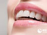 牙齿磨损严重怎么修复？
