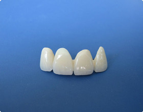 爱齿尔烤瓷牙材料