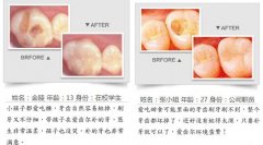 牙疼怎么办？