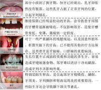 <b>拔牙多少钱？</b>